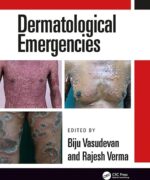 Dermatological Emergencies - Rajesh Verma