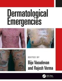 Dermatological Emergencies – Rajesh Verma, Biju Vasudevan – 1st Edition