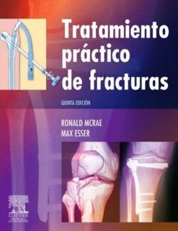 Tratamiento Práctico de Fracturas – Ronald McRae, Max Esser – 5ta Edición